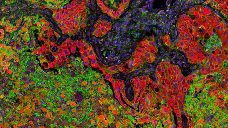 Biorepository and Tissue Analytics Shared Resource