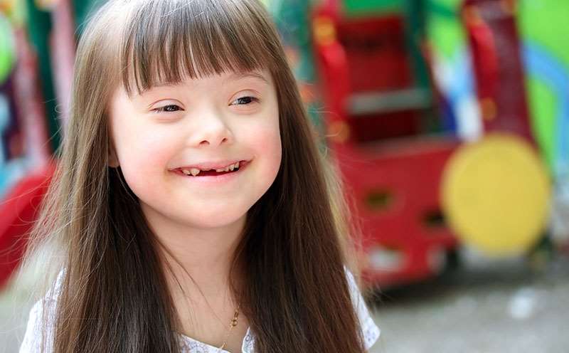 Girl with Down Syndrome 