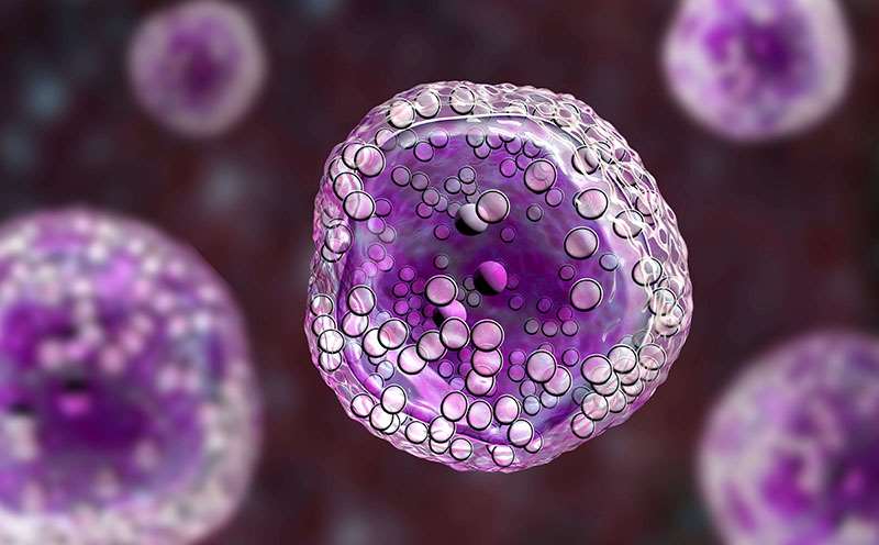 Photographic representation of lymphoma cells