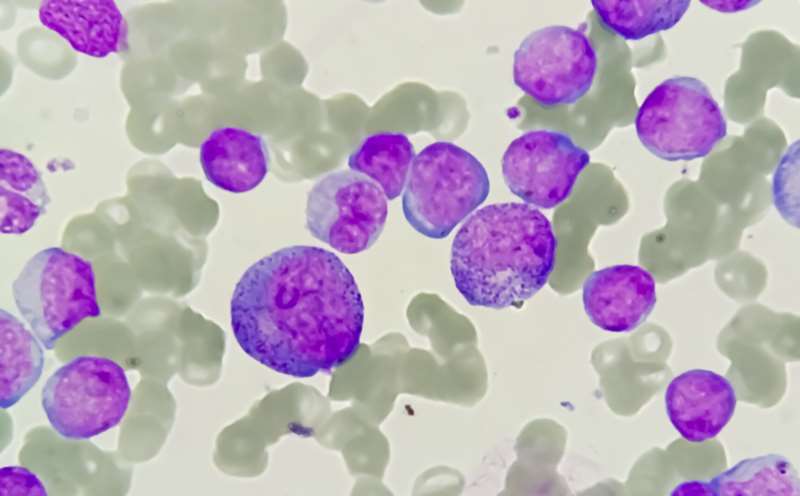 Acute Myeloid Leukemia Cells