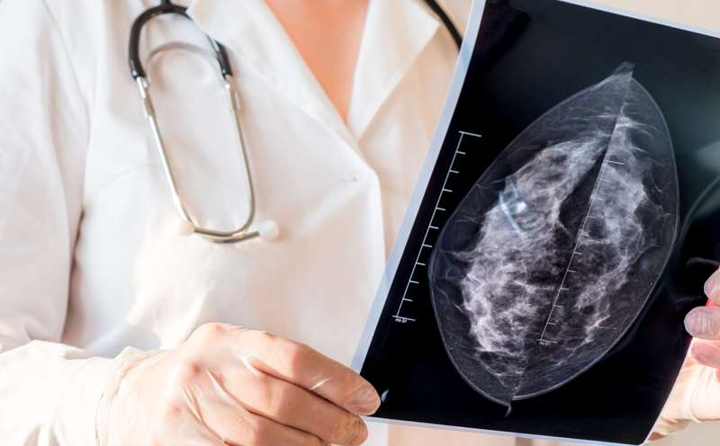 Doctor Viewing Mammography Results